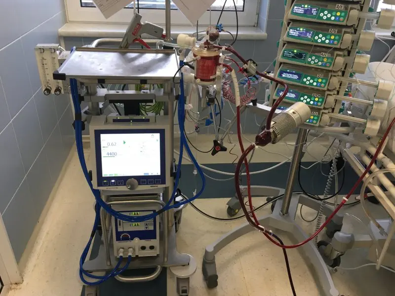 ECMO unit in intensive care connected to an oxygenator and pump maintaining blood flow.